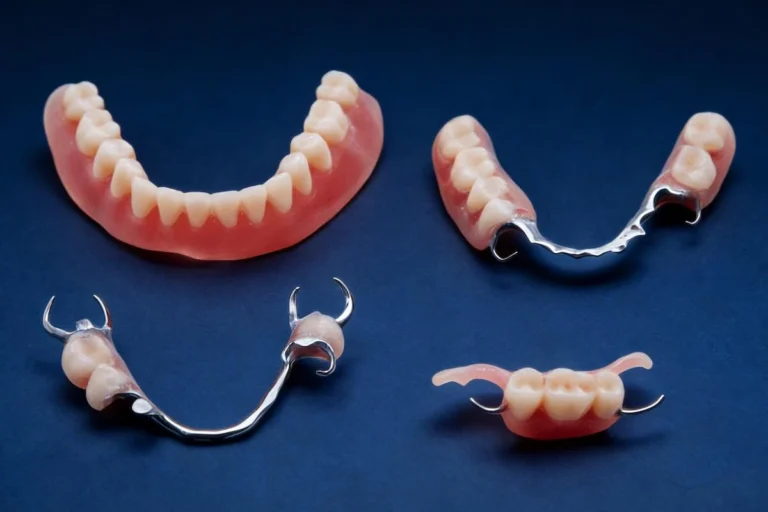 Removable Restorations Outsourcing