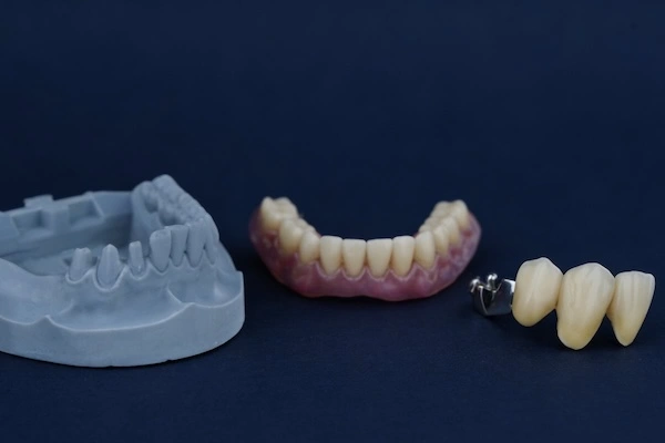 Precision Dental Attachment Outsourcing