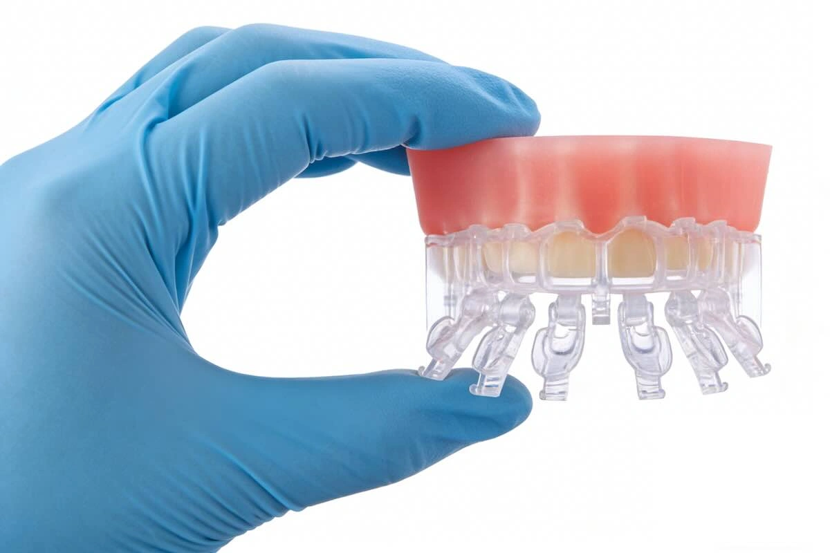 Dental Veneers Outsourcing