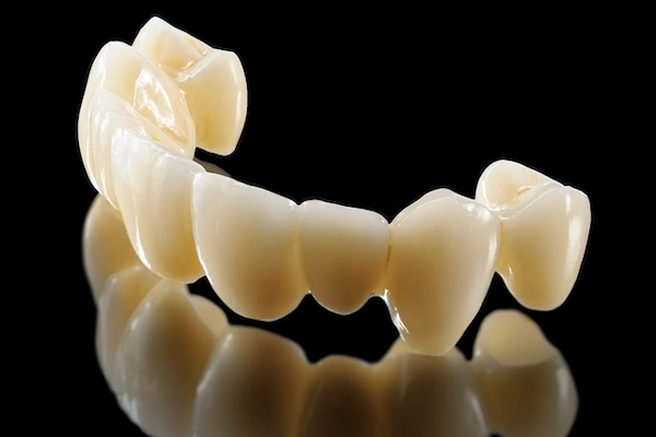 Full Cast Outsourcing Guide