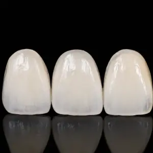 Standard Zirconia Veneers