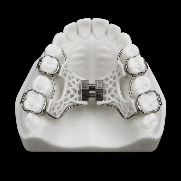 3D Printed Bonded Expander