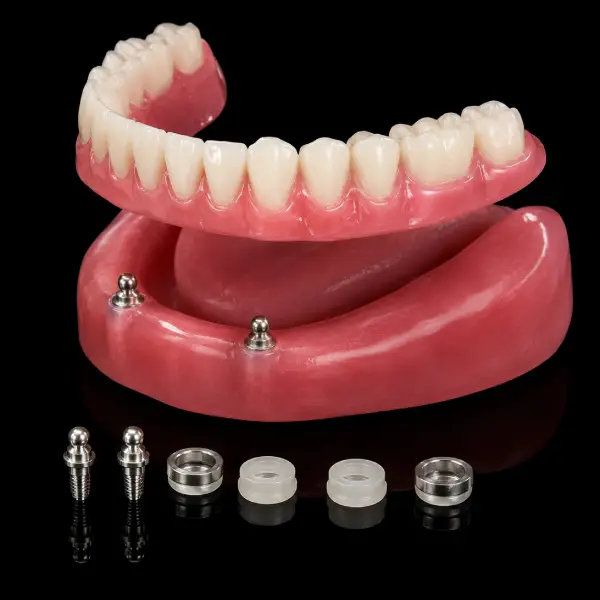 Ball Attachment Implant Overdenture
