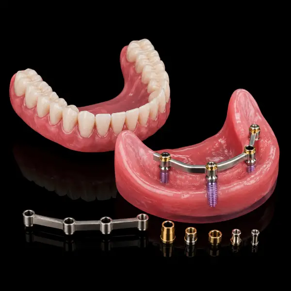 Bar-Retained Implant Overdenture