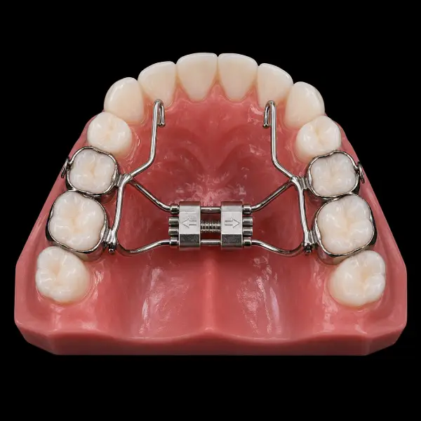 Bonded Expander with Protraction Hooks