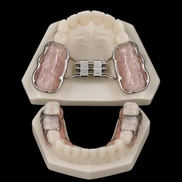 Bonded Hyrax Expander