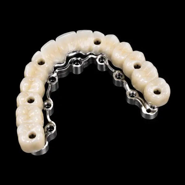 CAD CAM Milled Hybrid Denture