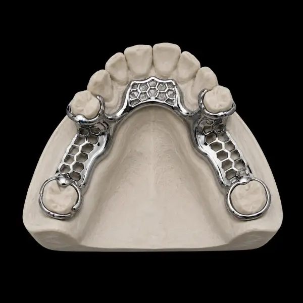 CAD/CAM Cobalt-Chrome Framework