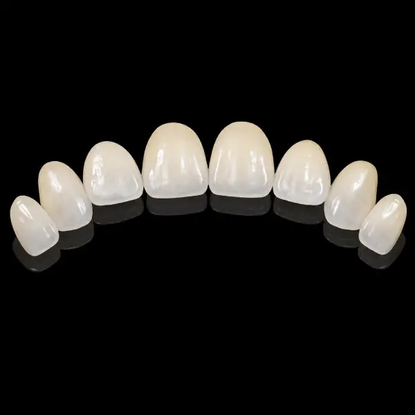CAD/CAM E.max Veneers