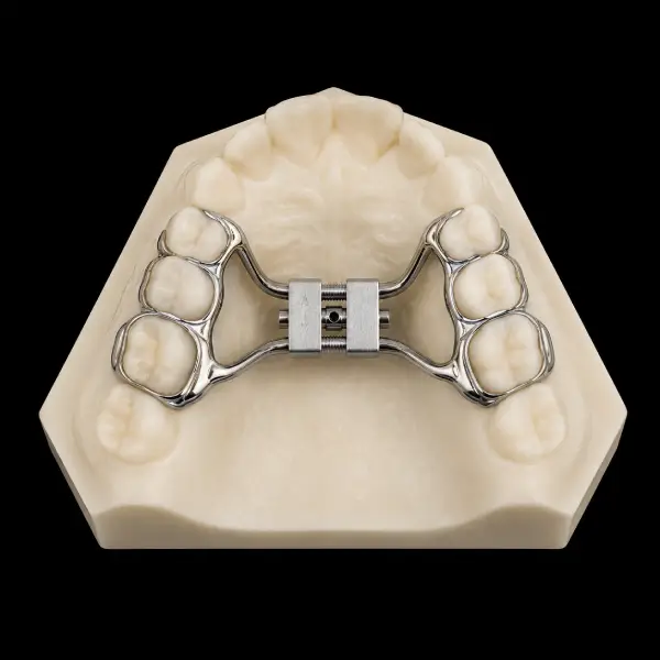 CAD/CAM Hyrax Rapid Palatal Expander