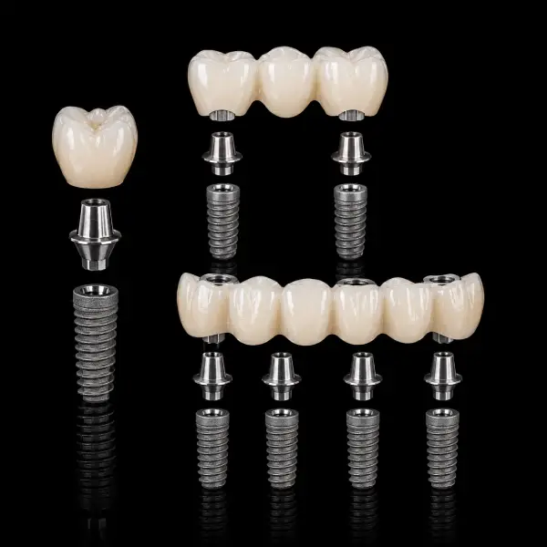 CAD CAM Implant Crown & Bridge