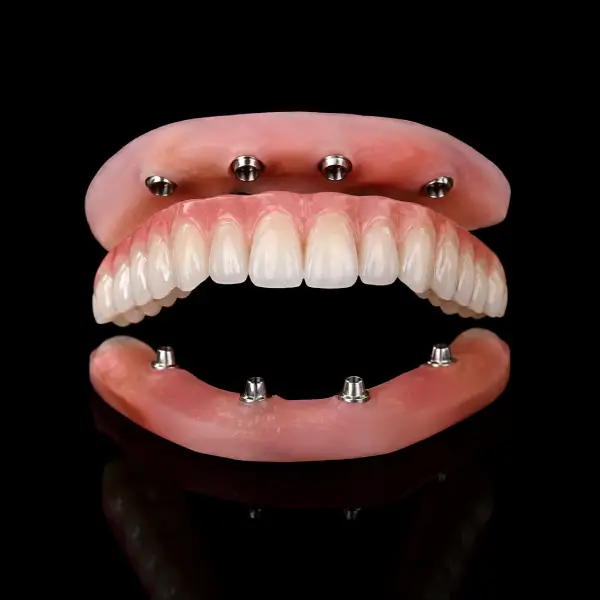 CAD CAM Milled All-on-46 Prosthesis