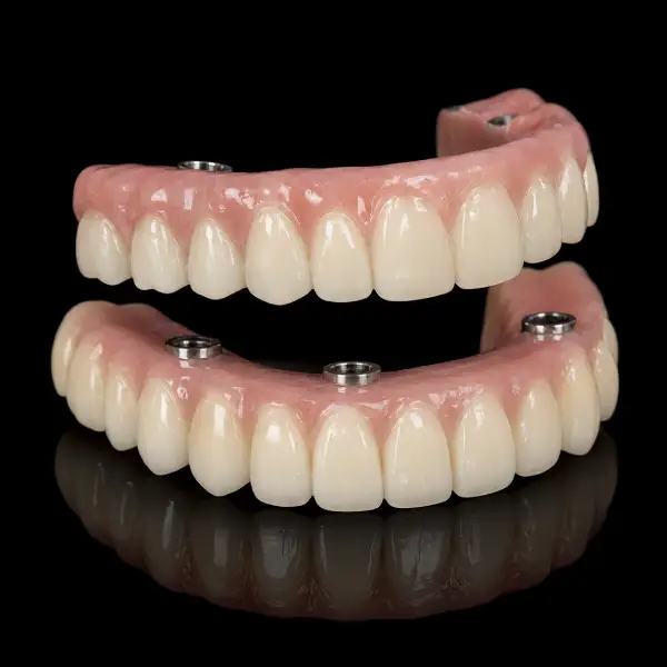 CAD/CAM Milled Malo Bridge