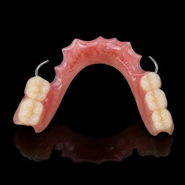 Characterized Partial Acrylic Denture