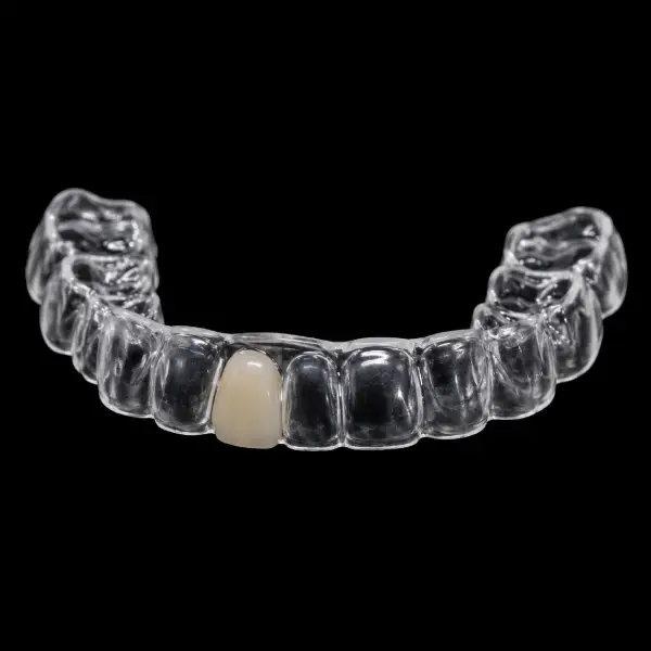 Clear Retainer with Pontic