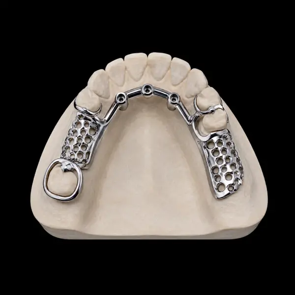 Cobalt-Chrome Implant Overdenture Bar Framework