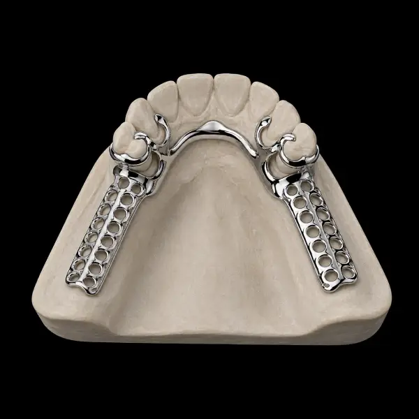 Cobalt-Chrome Partial Denture Frameworks