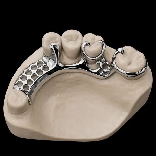Cobalt-Chrome Removable Framework with Clasps