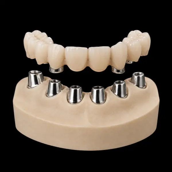 Conventional Telescopic Bridge