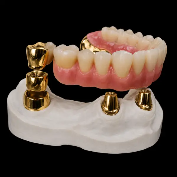Cylindrical Yellow Gold Telescopic Crowns
