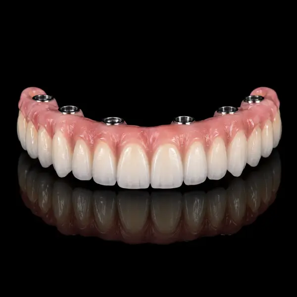 Full Arch Layered Zirconia Restorations