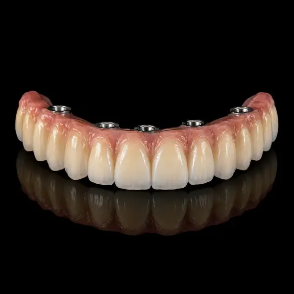 Full Arch Multilayer Zirconia Restorations