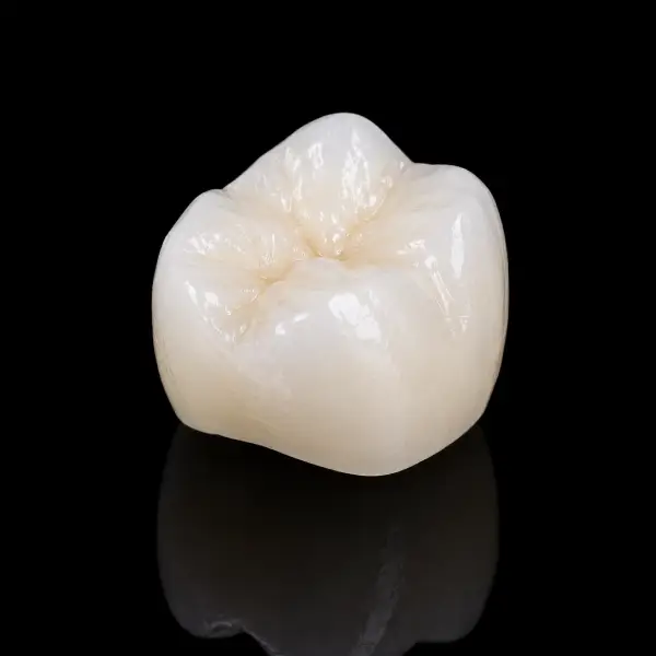 Full Contour Cement-Retained Zirconia Crown