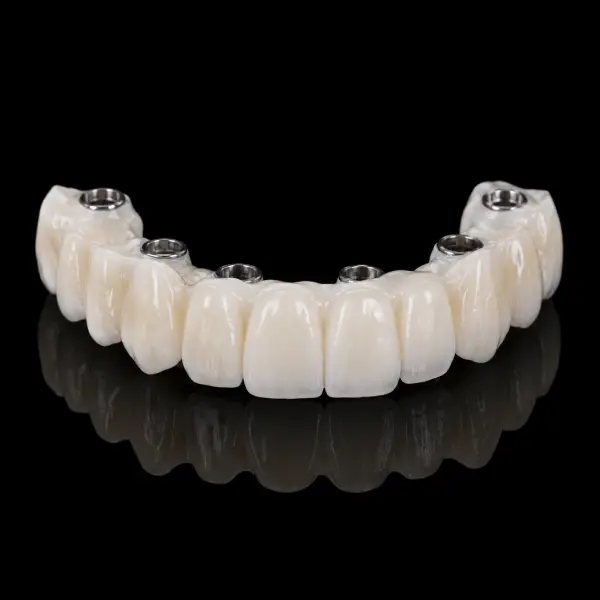 Full Contour Zirconia Implant Bridges