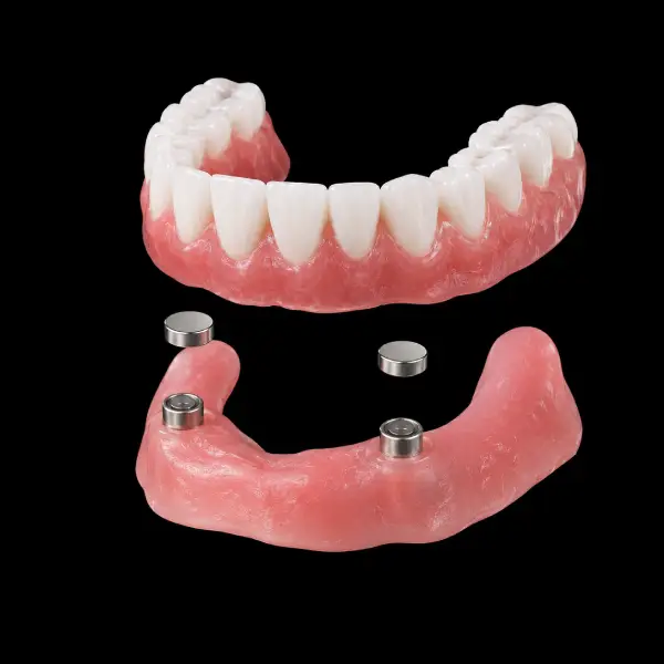 High-Retention Magnetic Attachment