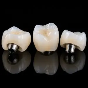 High Translucency Zirconia Implant Crown