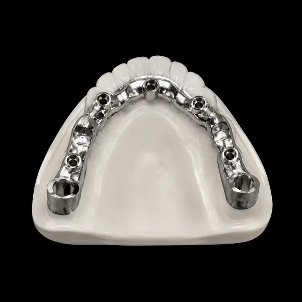 Hybrid Denture Titanium Framework