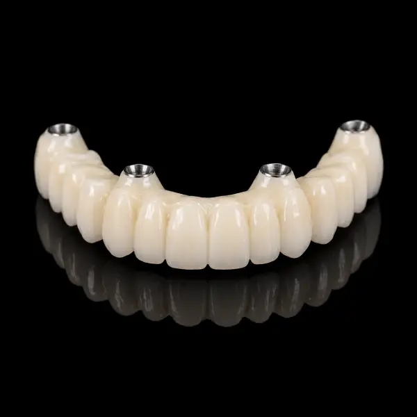 Immediate Load PMMA Temporary Restoration