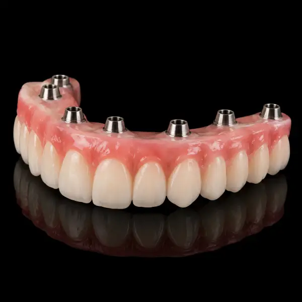 Immediate PMMA All-on-46 Prosthesis