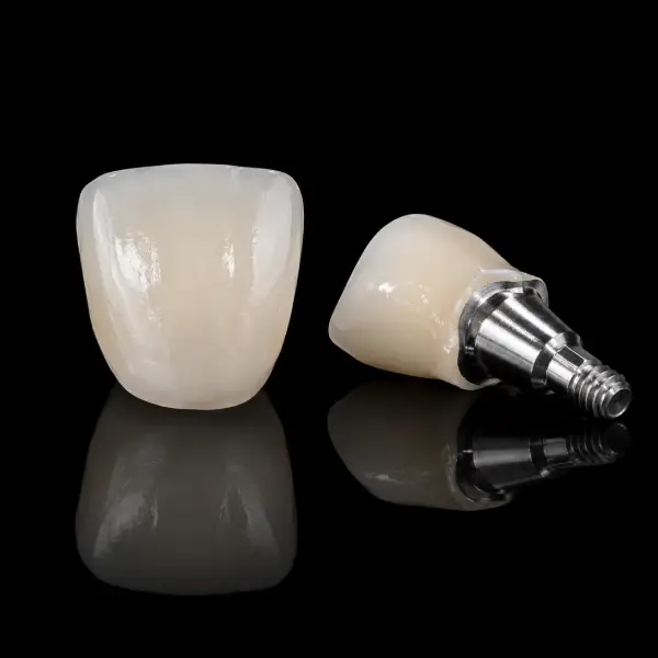 Implant E.max Crown