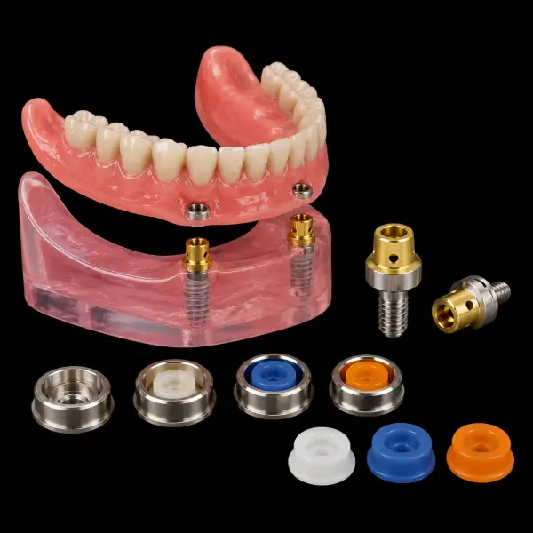 Implant ERA Attachment