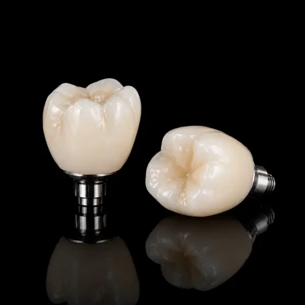 Implant Porcelain-Fused-to-Zirconia Crown (PFZ)