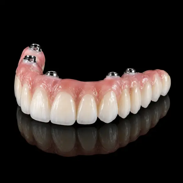 Implant-Supported Zirconia Bridges