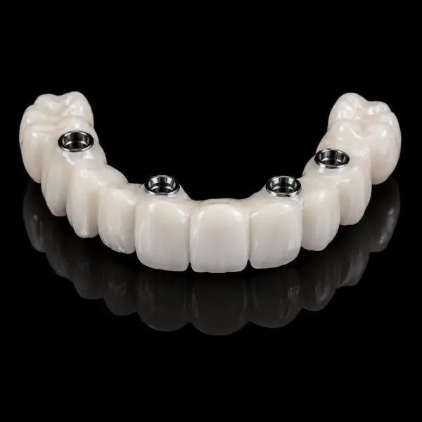Implant Zirconia Bridge