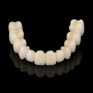Layered Zirconia Bridges