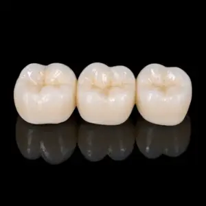 Layered Zirconia Crowns