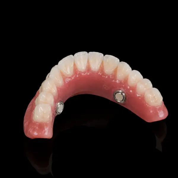 Low-Profile Magnetic Attachment
