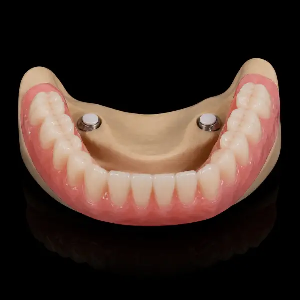Low-Profile Stud-Snap Attachment