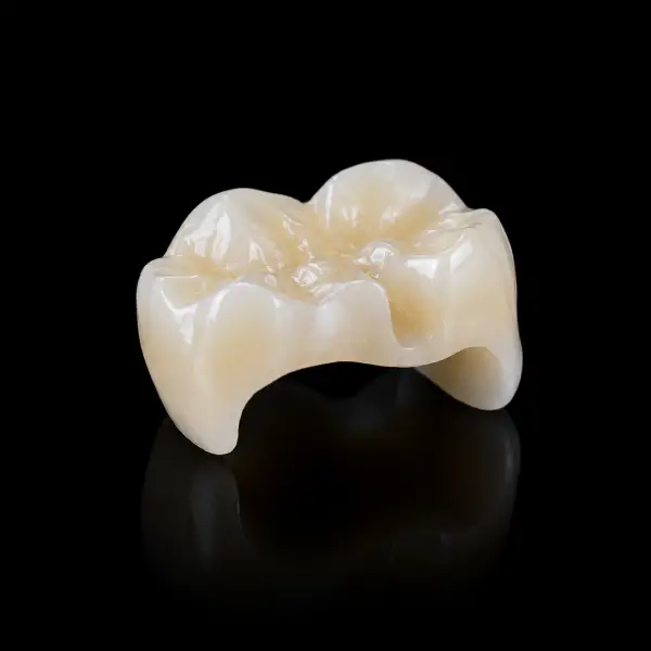 Low-Translucency E.max Inlay