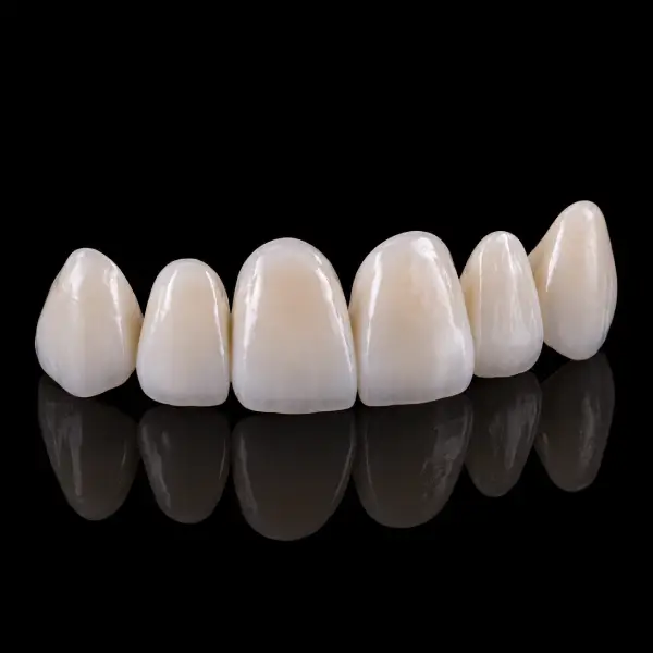 Monolithic Anterior Zirconia Crowns