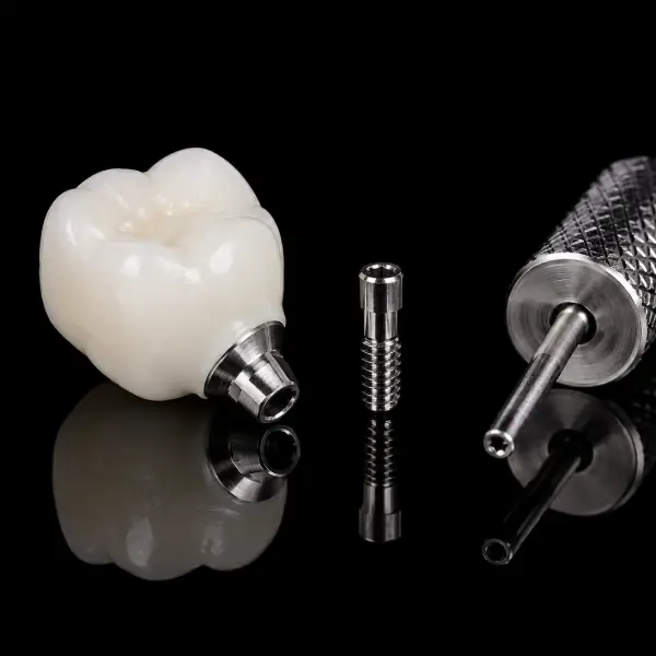 Monolithic Screw-Retained Zirconia Crown