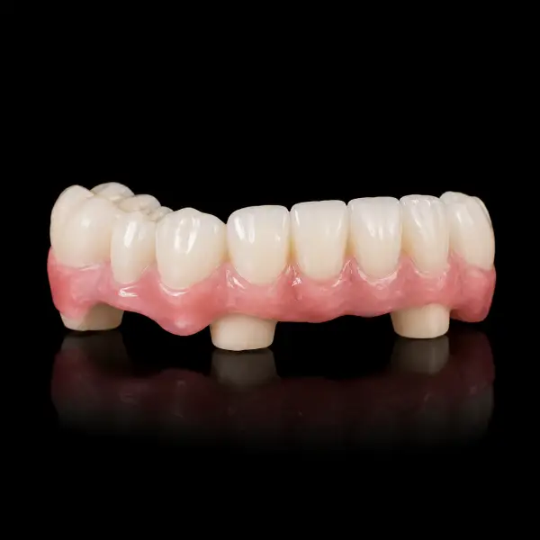 Multi-Unit Temporary Bridge with Gum