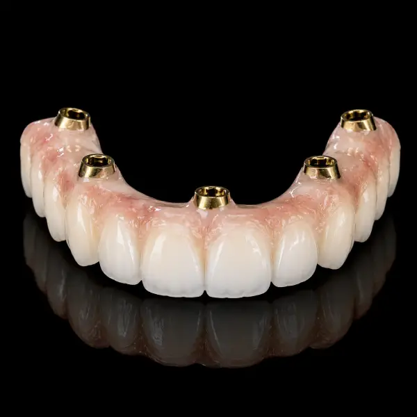Nano Ceramic Malo Bridge