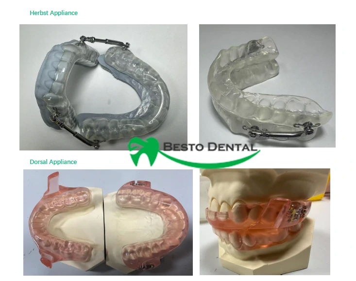 Orthodontic Appliance Outsourcing