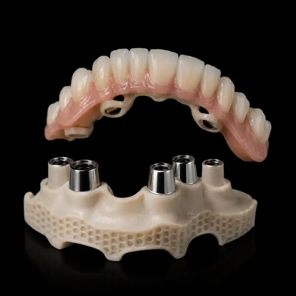 PEEK Telescopic Partial Denture