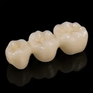 Posterior Zirconia Bridges